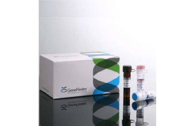 [COVID-19] Gene finder COVID-19 PCR RealAMP kit
