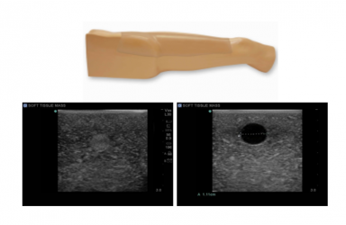 [PC-BPE016] 연조직 종괴 초음파 팬텀_다리