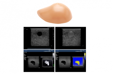 [PC-BPE029,029.1] 유방 초음파 팬텀_탄성 영상 및 생검, 생검전용