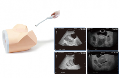 [US-10] 부인과 초음파 팬텀